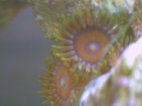 polyps.JPG