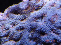 acan brain 2.jpg